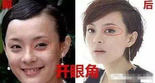 quot;Mị Nguyệtquot; Tôn Lệ thừa nhận mình từng quot;dao kéoquot; - 4