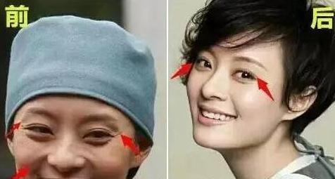 quot;Mị Nguyệtquot; Tôn Lệ thừa nhận mình từng quot;dao kéoquot; - 3