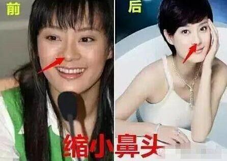 quot;Mị Nguyệtquot; Tôn Lệ thừa nhận mình từng quot;dao kéoquot; - 6