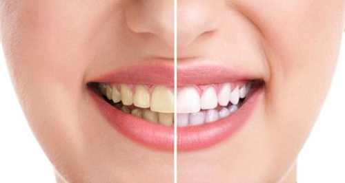 Ham uống nước chanh coi chừng có hại - 1