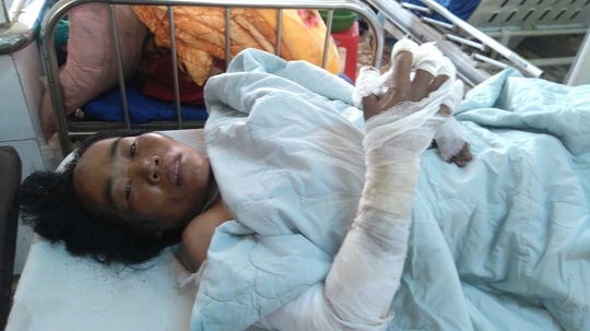 Bé 13 tháng tuổi phỏng nặng vì xăng để trong nhà - 1