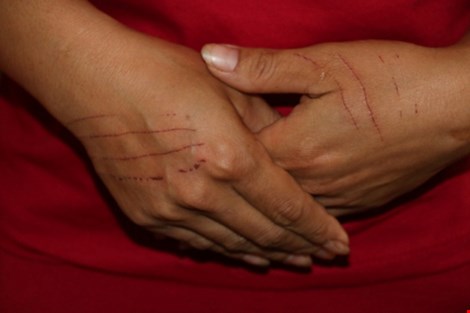 Hai mẹ con bị hàng xóm rạch mặt dã man - 2