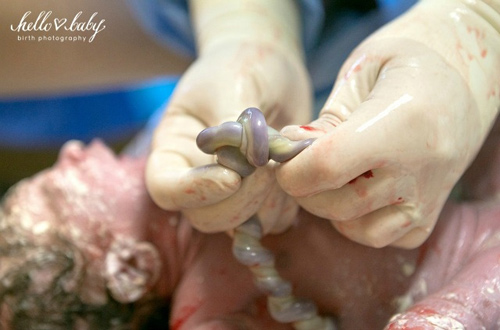 58 bộ ảnh và những cảnh sinh nở cảm động nhất năm - 2