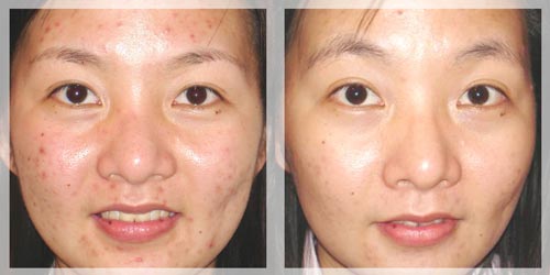 Bật mí 3 công thức làm đẹp siêu rẻ từ 1 nắm rau má - 5