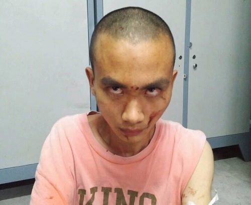 Án mạng tại chùa 6 người thương vong: Nhà chùa biết đối tượng bị bệnh tâm thần trước đó - 2