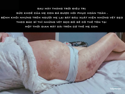Chấp nhận căn bệnh có thể tàn phá nội tạng, mẹ Việt vẫn quyết sinh con - 14