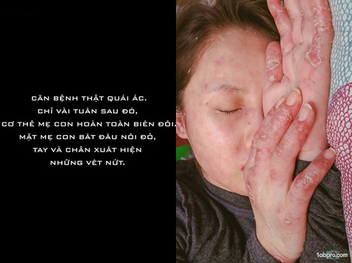 Chấp nhận căn bệnh có thể tàn phá nội tạng, mẹ Việt vẫn quyết sinh con - 4