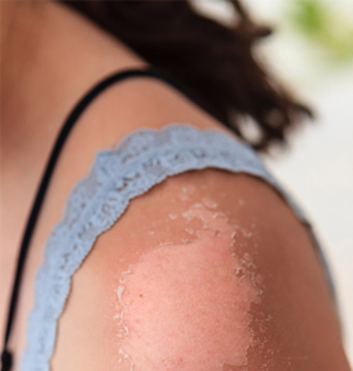 99% chị em sẽ mua Vitamin E ngay khi biết được những điều này - 8
