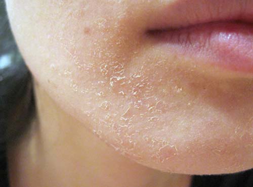99% chị em sẽ mua Vitamin E ngay khi biết được những điều này - 7