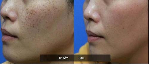 99% chị em sẽ mua Vitamin E ngay khi biết được những điều này - 5