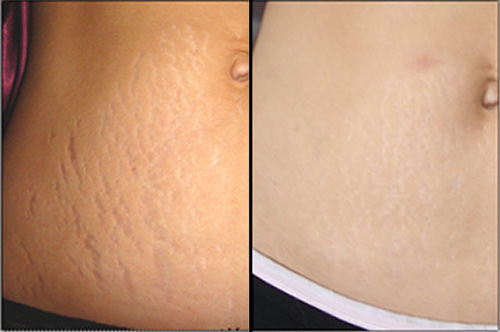 99% chị em sẽ mua Vitamin E ngay khi biết được những điều này - 4
