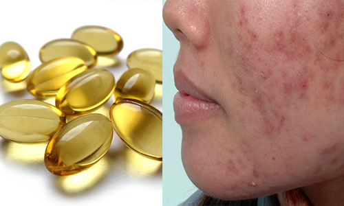 99% chị em sẽ mua Vitamin E ngay khi biết được những điều này - 3
