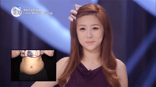 Cặp song sinh hot nhất tuần: Màn lột xác ngoạn mục nhờ phẫu thật thẩm mỹ - 10