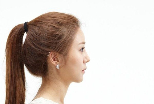 Cặp song sinh hot nhất tuần: Màn lột xác ngoạn mục nhờ phẫu thật thẩm mỹ - 5