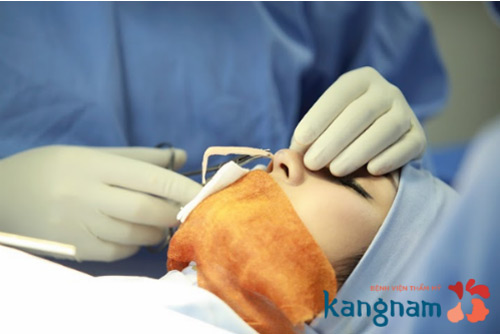 Chuyên khoa thẩm mỹ mũi ưu đãi 20% cho phái đẹp trong tháng 10 - 3
