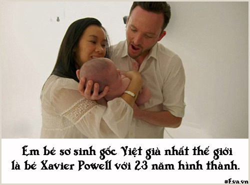 Những chuyện sinh nở đặc biệt không ai có thể quot;đụng hàngquot; - 10