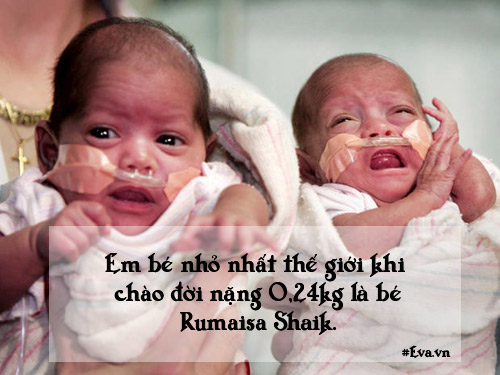 Những chuyện sinh nở đặc biệt không ai có thể quot;đụng hàngquot; - 4