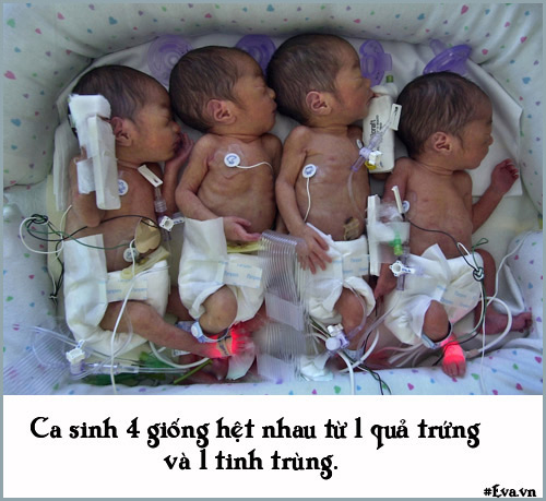 Những chuyện sinh nở đặc biệt không ai có thể quot;đụng hàngquot; - 8
