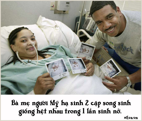 Những chuyện sinh nở đặc biệt không ai có thể quot;đụng hàngquot; - 9