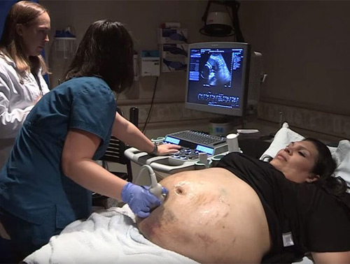 Mới mang bầu đã thấy nhiều vết thâm tím, bà mẹ ‘sốc nặng’ khi nhận tin từ bác sĩ - 2