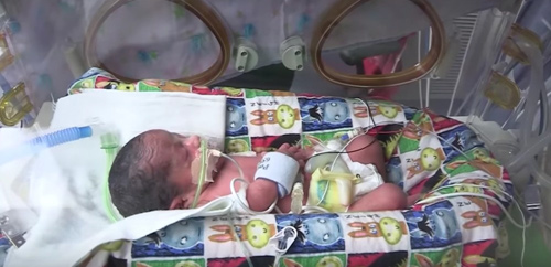 Mới mang bầu đã thấy nhiều vết thâm tím, bà mẹ ‘sốc nặng’ khi nhận tin từ bác sĩ - 6