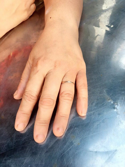 Những bi kịch đau đớn khi ngày cưới bỗng chốc biến thành đại tang - 2