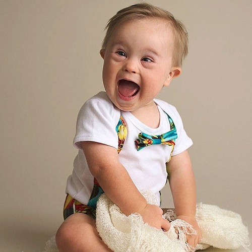 The son with Down syndrome and the mother did something that made thousands of people admire - 2