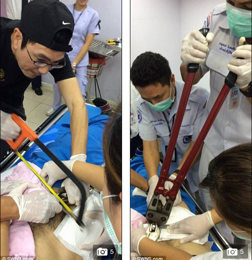 Chàng trai TQ bị mắc kẹt chiếc đũa dài trong quot;của quýquot; khi tự khám bệnh - 2