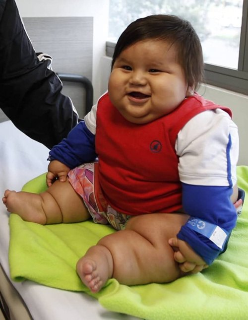 10 đứa trẻ quot;béo nhất thế giớiquot; khiến ai cũng phải kinh ngạc - 1