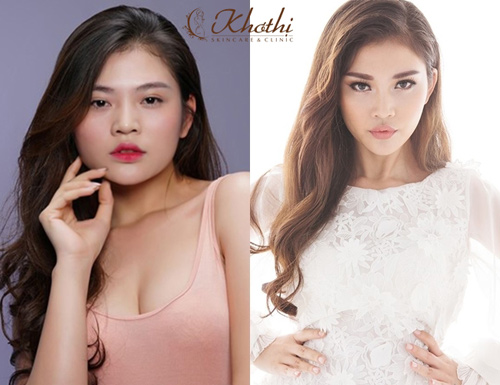 Chúng Huyền Thanh chia sẻ bí quyết sở hữu mặt V-line như ý - 7