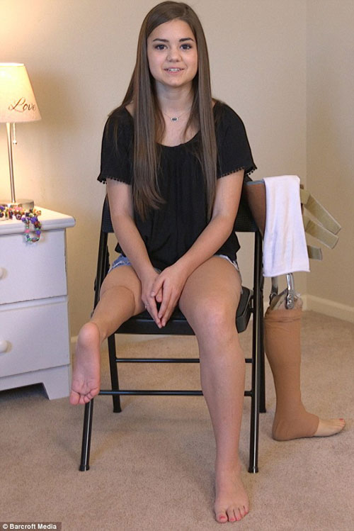 Cô gái ung thư trở thành vũ công ballet dù chỉ có 1 chân khiến triệu người nể phục - 4