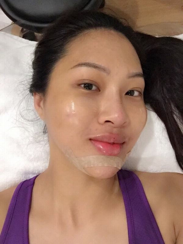 Hoa khôi Diệu Ngọc bị lộ loạt ảnh phẫu thuật thẩm mỹ - 6