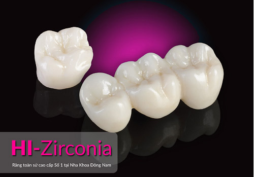 Nha Khoa Đông Nam ra mắt răng sứ cao cấp HI–Zirconia - 1