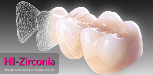 Nha Khoa Đông Nam ra mắt răng sứ cao cấp HI–Zirconia - 4