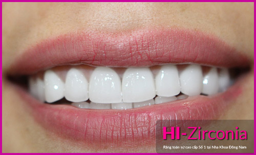 Nha Khoa Đông Nam ra mắt răng sứ cao cấp HI–Zirconia - 3