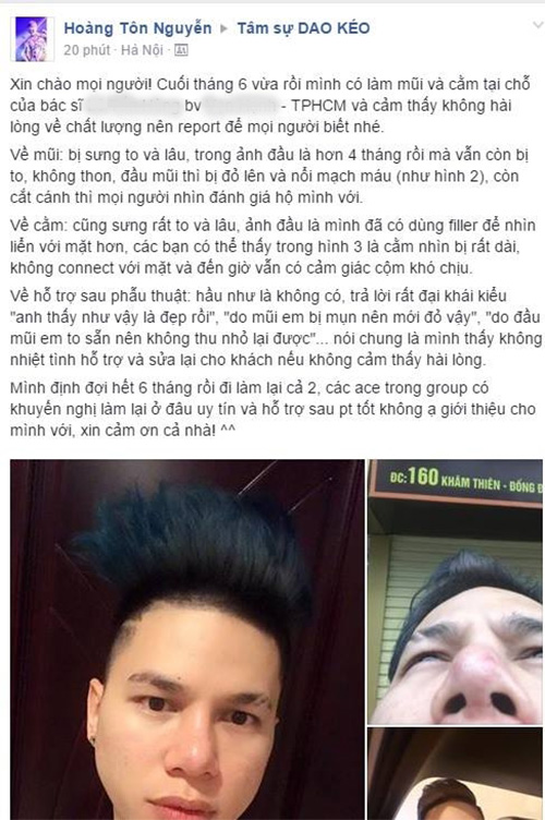 Hoàng Tôn không ân hận vì phẫu thuật thẩm mỹ, chỉ tiếc vì tin nhầm bác sỹ - 3