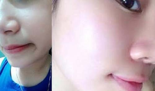 Mặt nạ bánh đa nem, bí kíp giúp da khô nẻ ngay lập tức căng mướt, mềm mịn trong mùa đông - 7