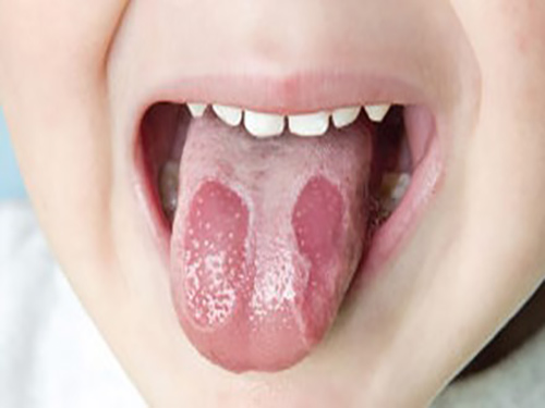 10 dấu hiệu cảnh báo bạn có thể đã mắc ung thư giai đoạn đầu - 2