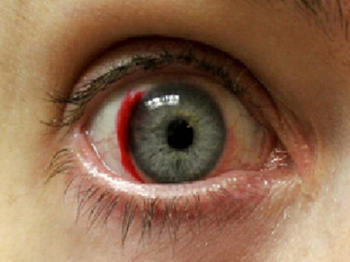 5 dấu hiệu bất thường trên mặt cảnh báo các bệnh nguy hiểm - 4