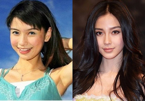 Sao châu Á đổi vận nhờ nâng mũi - 1