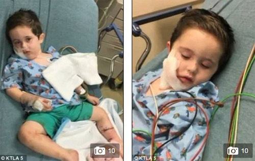 Khoảnh khắc mẹ xả thân cứu con trai bị 2 con chó dữ lao vào cắn xé - 4