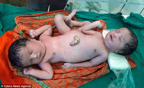 Những ca ‘siêu âm thai bình thường, sinh con dị dạng’ khiến cha mẹ chết lặng - 1