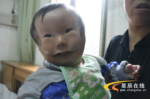 Những ca ‘siêu âm thai bình thường, sinh con dị dạng’ khiến cha mẹ chết lặng - 3