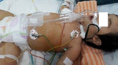 Xót thương bé gái 2 tuổi mắc nhiều bệnh hiểm nghèo một lúc - 1