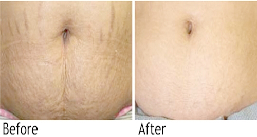 Bạn đã thử làm bình rượu gừng để trong nhà và cảm nhận hết sự diệu kỳ của nó chưa? - 5