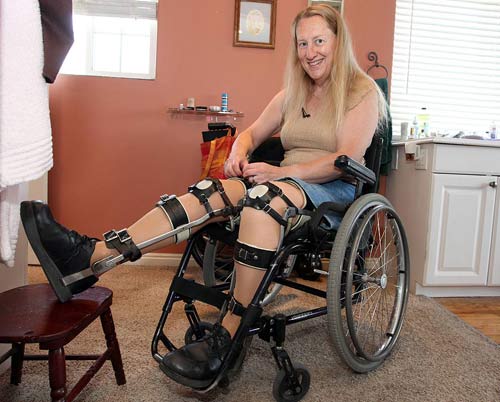 Căn bệnh kỳ quái nhất thế giới khiến nhân viên y tế cưa chân giấu trong tủ - 4