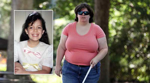 Căn bệnh kỳ quái nhất thế giới khiến nhân viên y tế cưa chân giấu trong tủ - 3