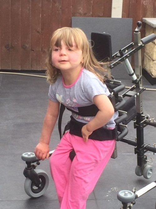 Khuôn mặt khác lạ sau phẫu thuật của bé gái bị chàm trên mặt - 4