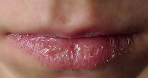 Môi thâm bẩm sinh đến mấy cũng sẽ hồng thắm với hỗn hợp này - 7