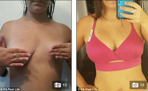 Ông bố bán nhà lấy tiền cho con gái... nâng ngực - 3